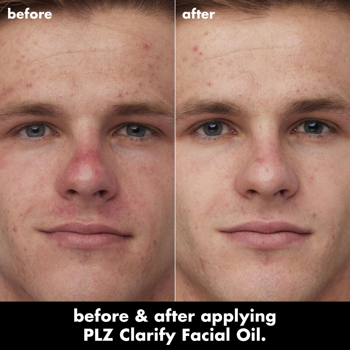 plz-clarify-facial-oil-p2 0326_EDU_PlzClarify_BA_Caleb.jpg