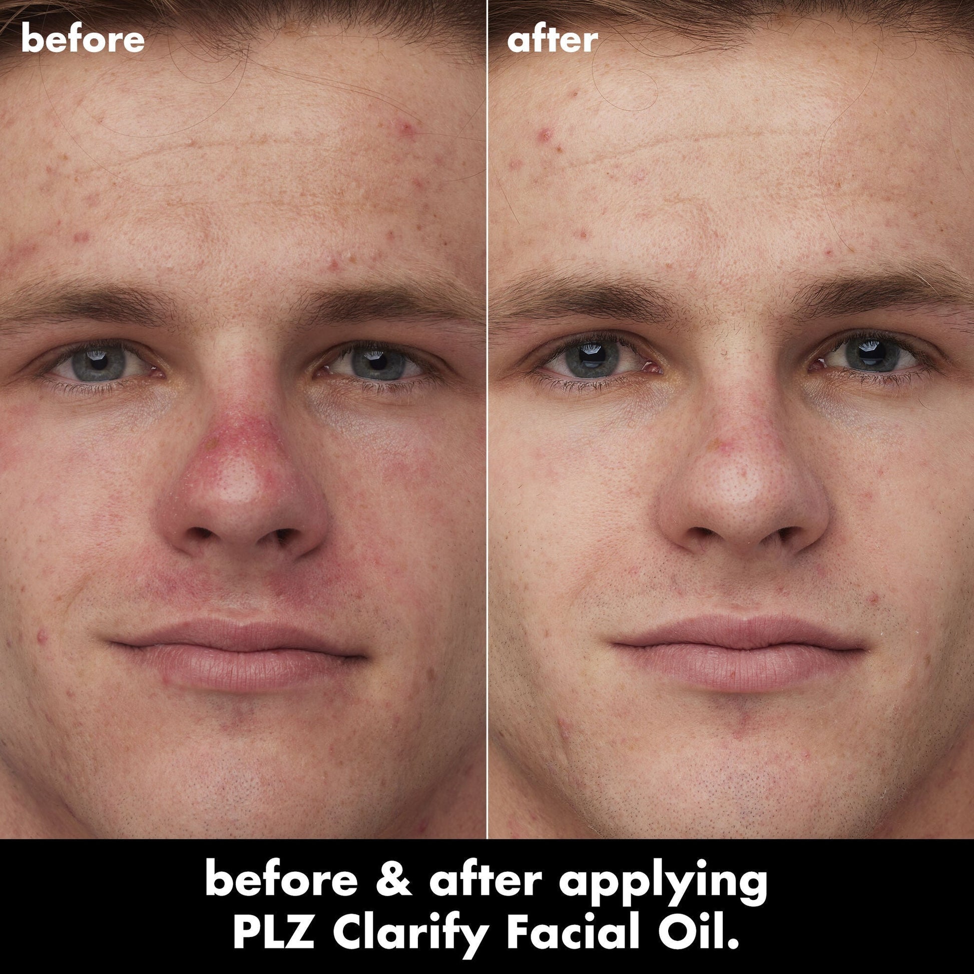 plz-clarify-facial-oil-p2 0326_EDU_PlzClarify_BA_Caleb.jpg