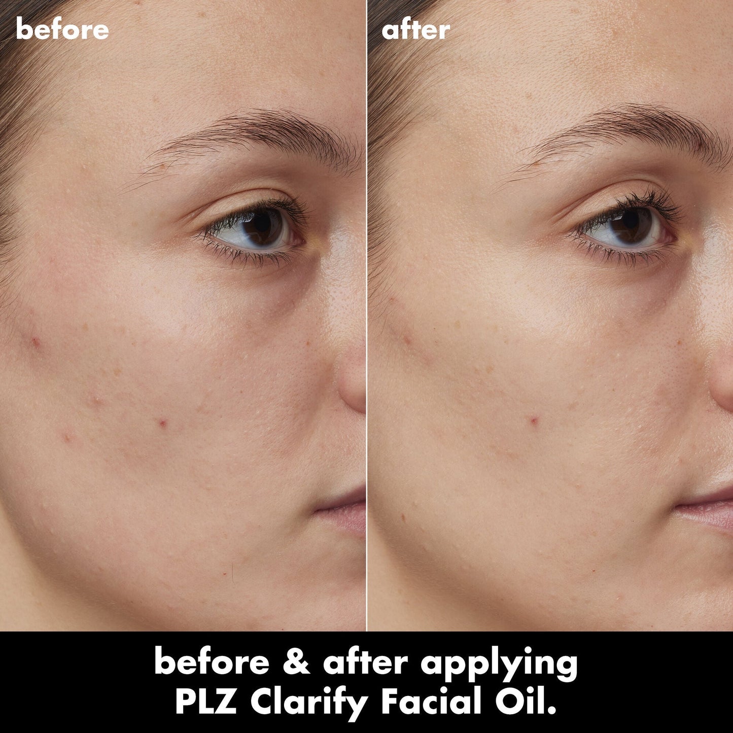 plz-clarify-facial-oil-p2 0326_EDU_PlzClarify_BA_Kelly.jpg