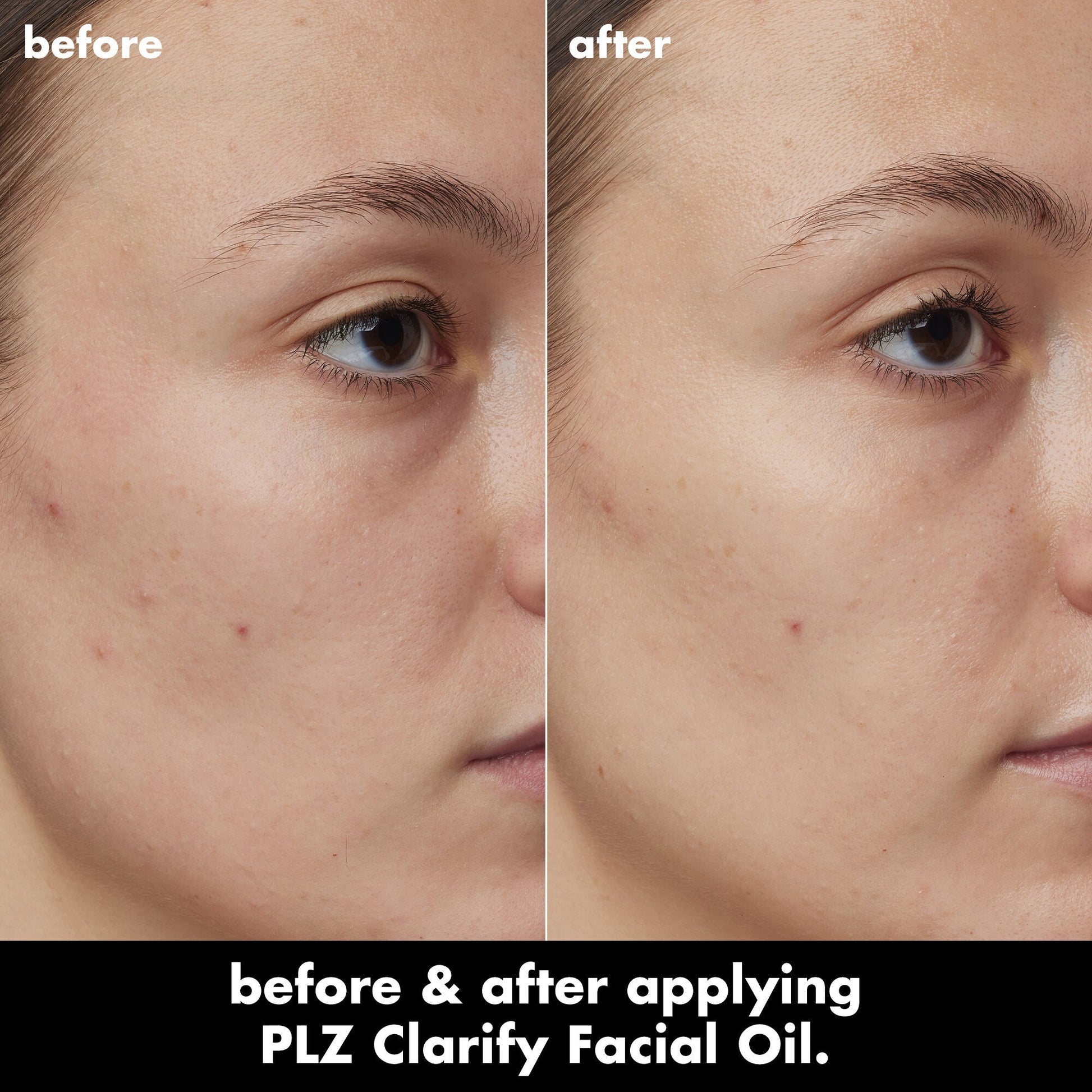 plz-clarify-facial-oil-p2 0326_EDU_PlzClarify_BA_Kelly.jpg