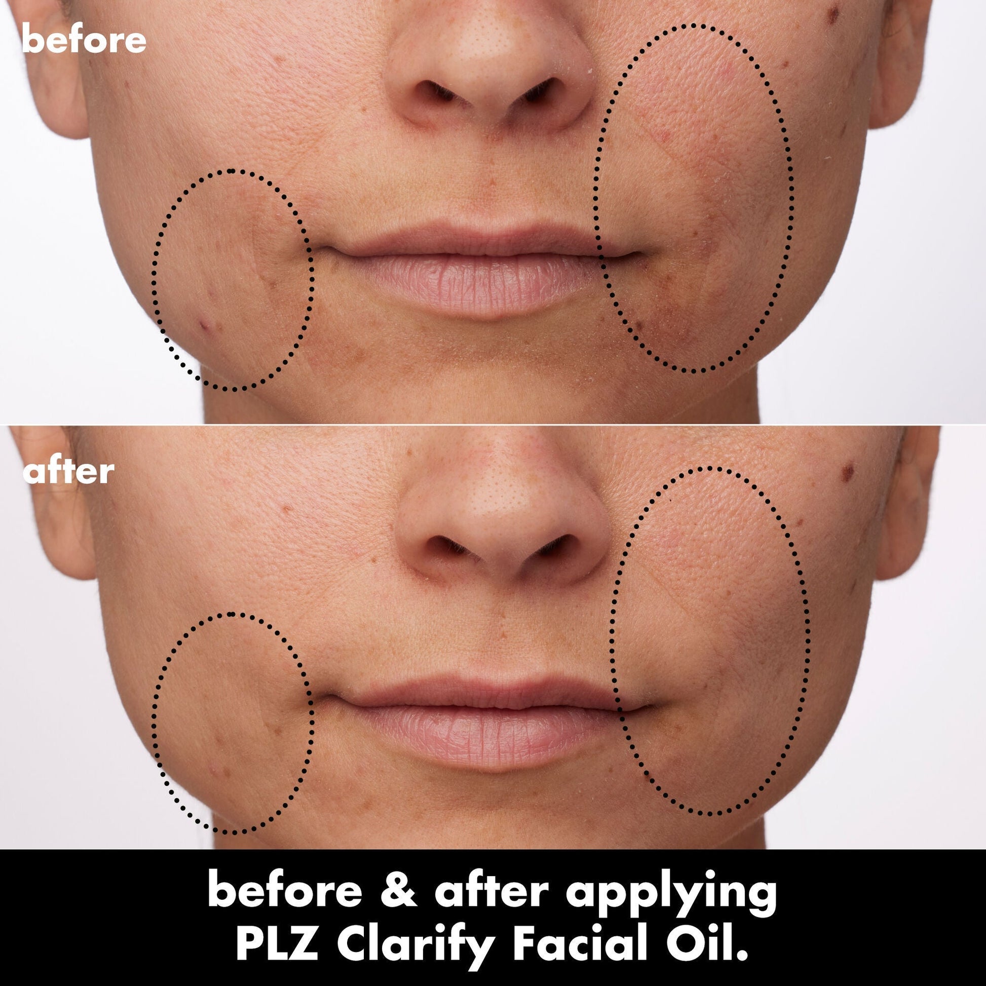 plz-clarify-facial-oil-p2 0326_EDU_PlzClarify_BA_Paula.jpg