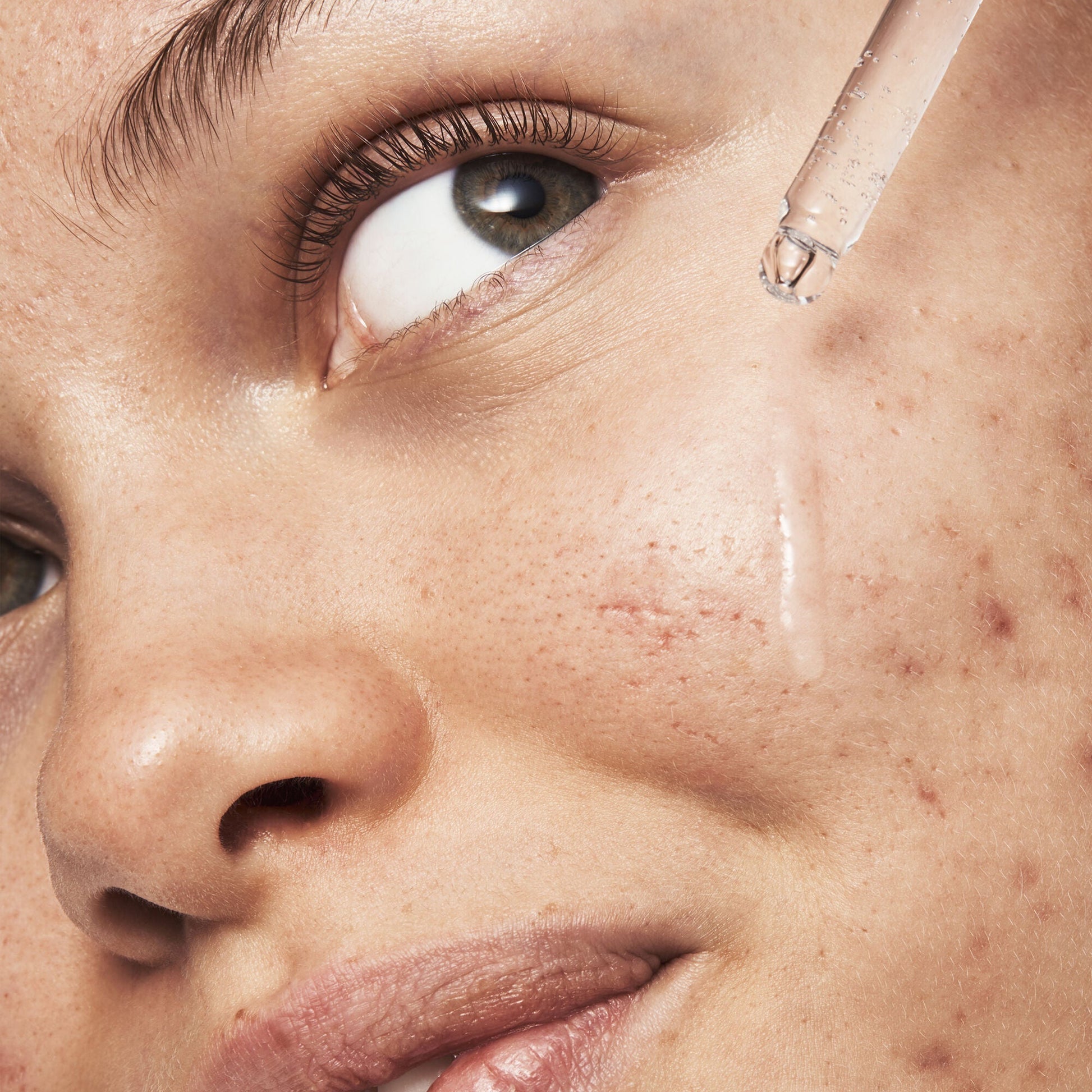 blemish-breakthrough-triple-acid-resurfacing-serum-y5 121321_Marley-Acne-Regimen_0254_FINAL_IGF.jpg