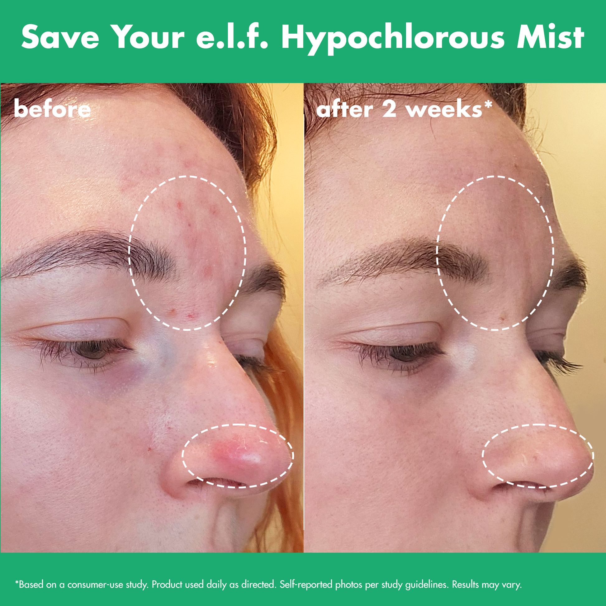 save-your-e-l-f-hypochlorous-mist-k5 FA26_EDUCATION_SAVEYOURELF_USAGE_BA1_WITHOUT_CLAIMS.png