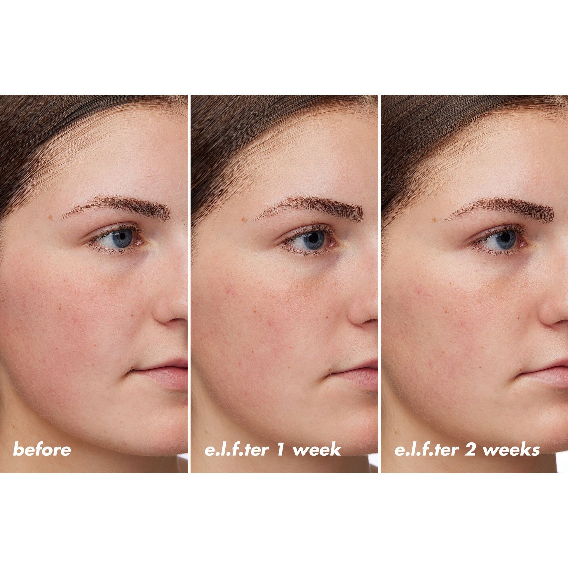 holy-hydration-barrier-goals-cream-regular-x6 XX26_EDUCATION_HH-BarrierGoals_B_A_Zoe_TRYPTICH_74c905bd-67bd-4b91-b633-2b01a8905cb8.jpg